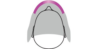 Curved auto-darkening filter
